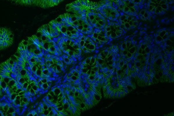 Intestinal epithelium