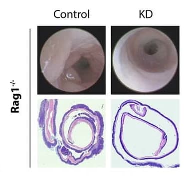 β-Hydroxybutyrate suppresses colorectal cancer