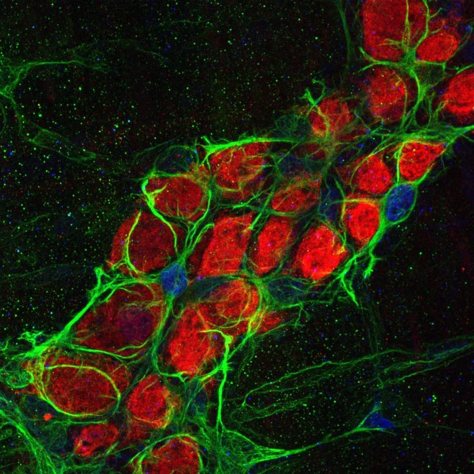 The enteric nervous system relays psychological stress to intestinal inflammation